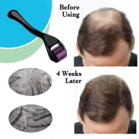 Derma Roller 0.5mm for Hair Growth & Skin Care – 540 Titanium Micro Needles | Anti-Aging, Skin Repair, Beard & Hair Regrowth Tool